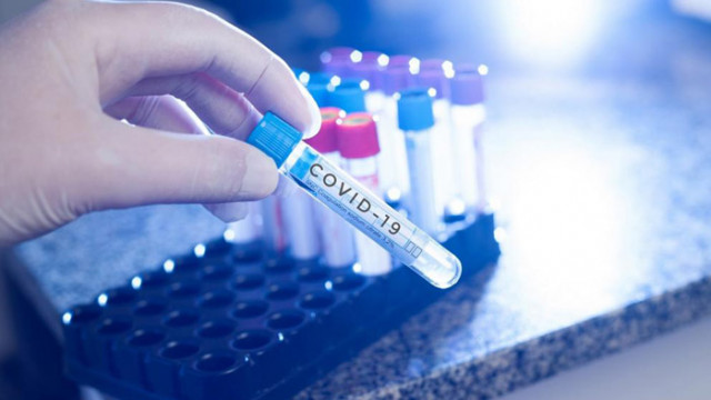 Двама контактни на пастора и 2 положителни проби на софиянци във Варна